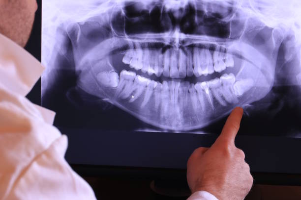 Best Pediatric Emergency Dentist in Lagunitas Forest Knolls, CA